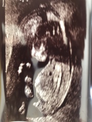 Gender guesses please 😊