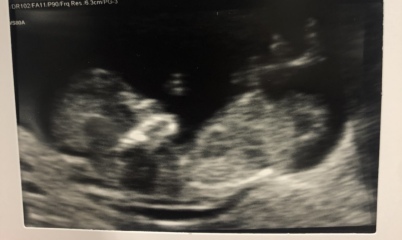 Babies due April 2023 Thread 6