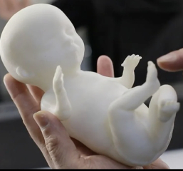 3D Printed Sonogram!