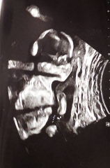 Gender guesses!
