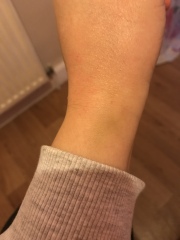 Any nurses about ?