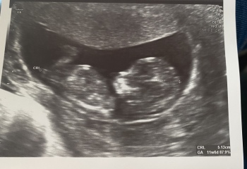 Babies due April 2023 Thread 6