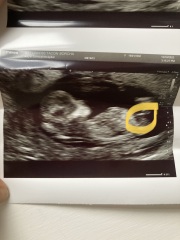 Gender guesses please :-)
