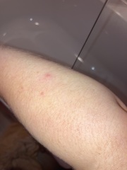 Can anyone identify this rash?