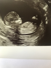 Babies due April 2023 Thread 6