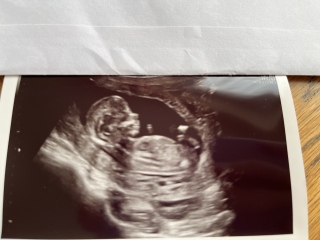 Babies due April 2023 Thread 6