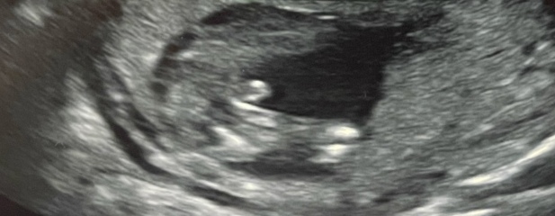 Girl or boy? Potty shot 