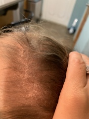 Scalp help!