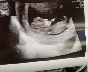 Babies due April 2023 Thread 6