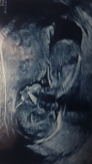 Baby gender 