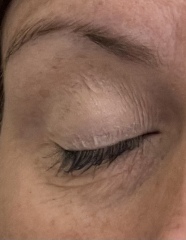 What to do with these wrinkly eyes 👀 