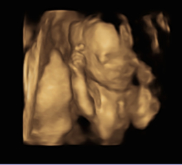 Due March 2023 - thread 4