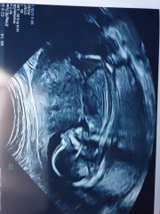 Baby gender 