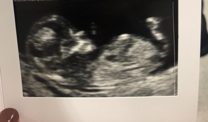 Babies due April 2023 Thread 6