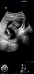 Boy or Girl ? 16 weeks potty shots