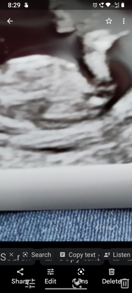 Potty Shot! Girl or Boy? 