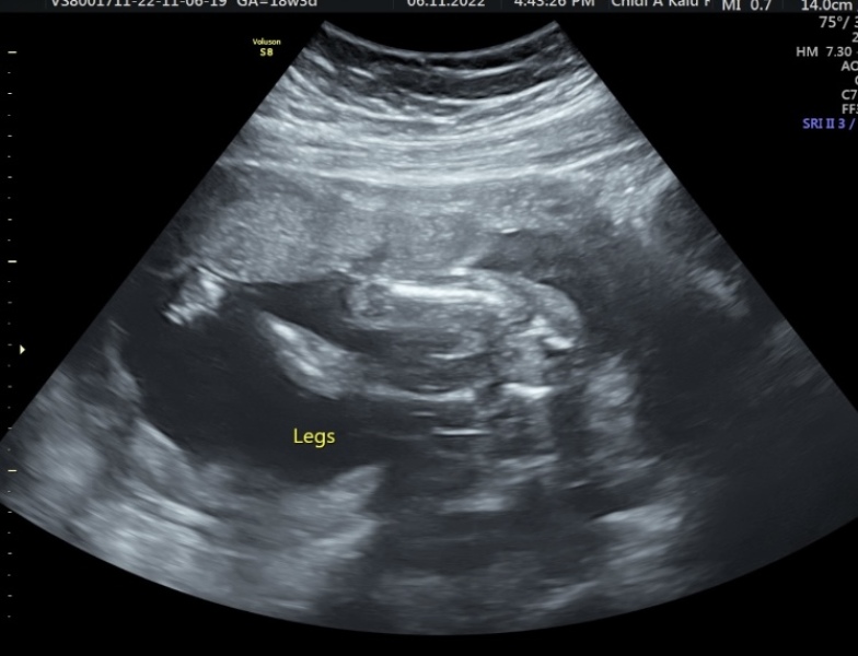 Girl or boy? Potty shot 