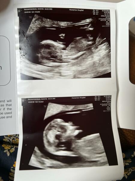 Any gender guesses?