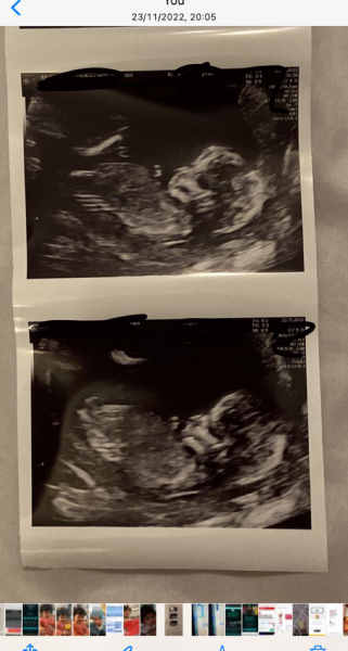 June 2023 Babies ☀️ (thread two)
