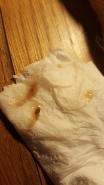 Could this be implantation bleeding? 