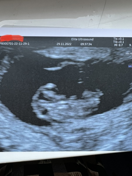June 2023 Babies ☀️ (Thread 3) 