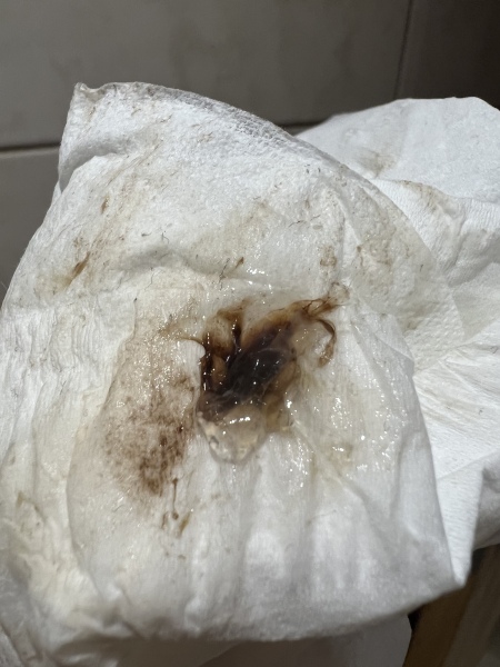 Spotting and cramping approx 5 weeks pregnant (TW possible TMI!)