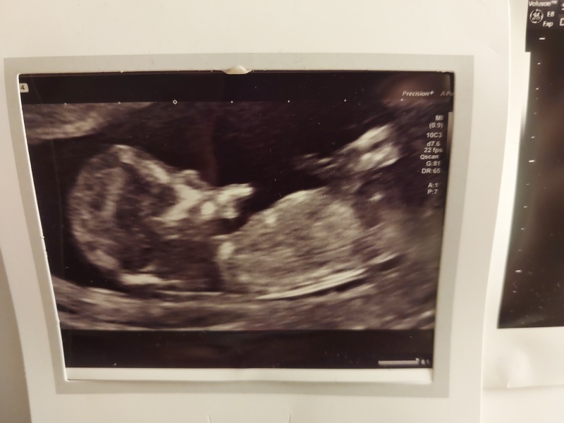 Can anyone guess girl or boy from my scan photos? 