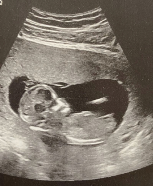 Nub Theory! Gender guesses please 