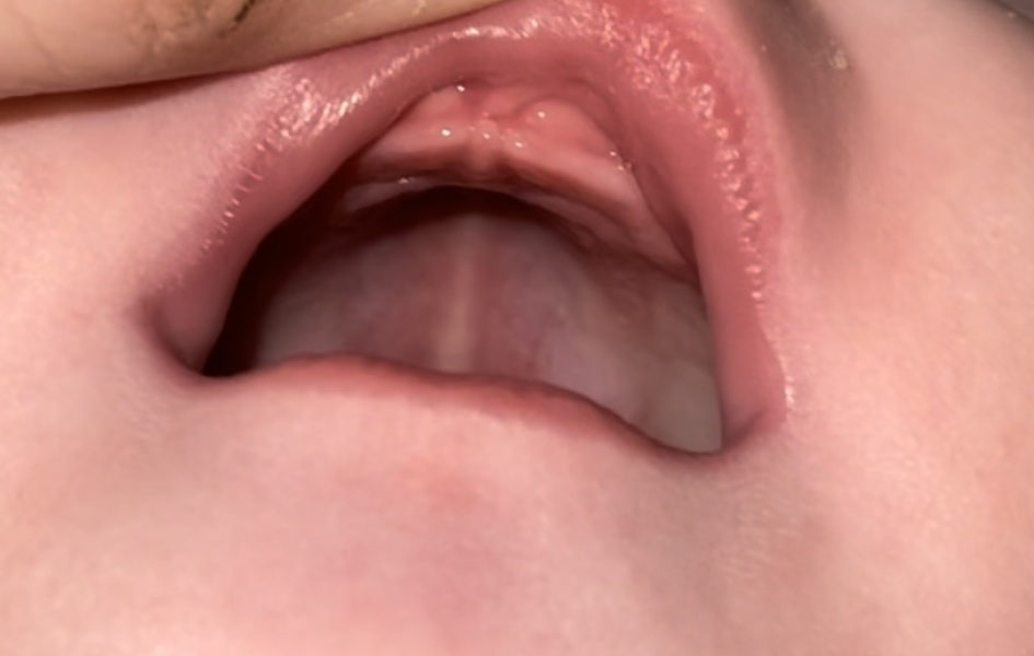 Is this the start of teething?! PICS