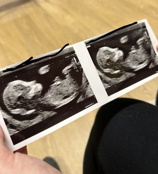 No nub? Gender guesses please! 