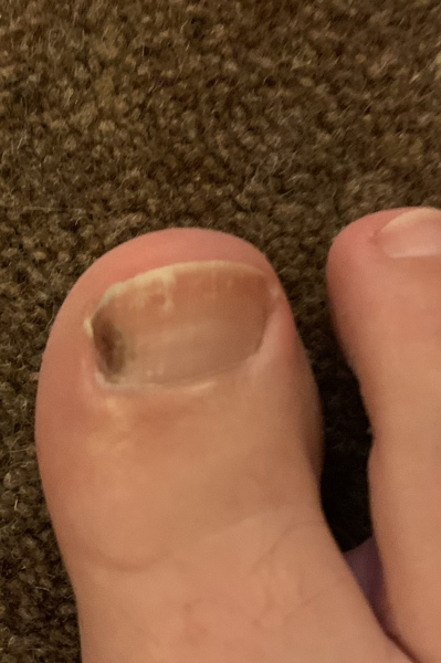 What's this on my nail?