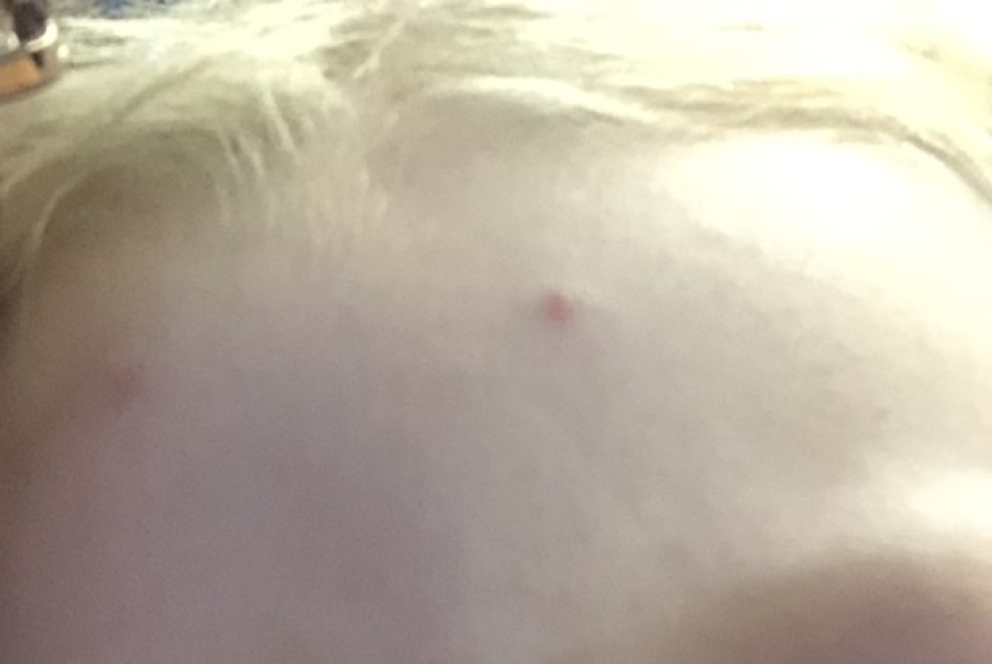 Chicken pox?? Help!