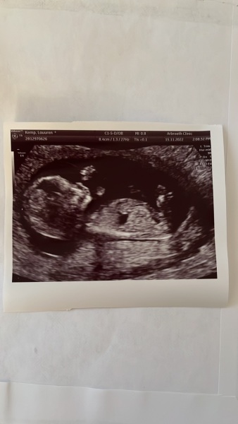 Gender Guesses - Boy or Girl?