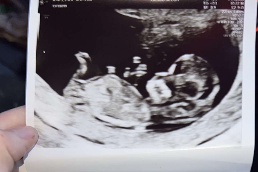 Girl or boy?!?!??? 