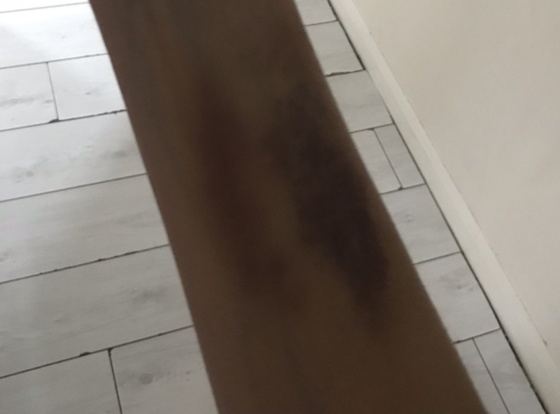 Quite upset with care received by NHS