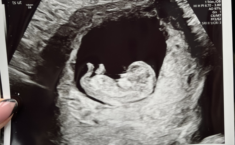 Cramping and spotting 5 weeks 