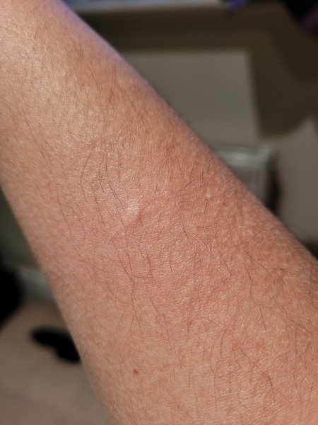 What the hell keeps biting me?!