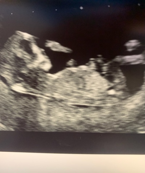 June 2023 Babies ☀️ (thread two)