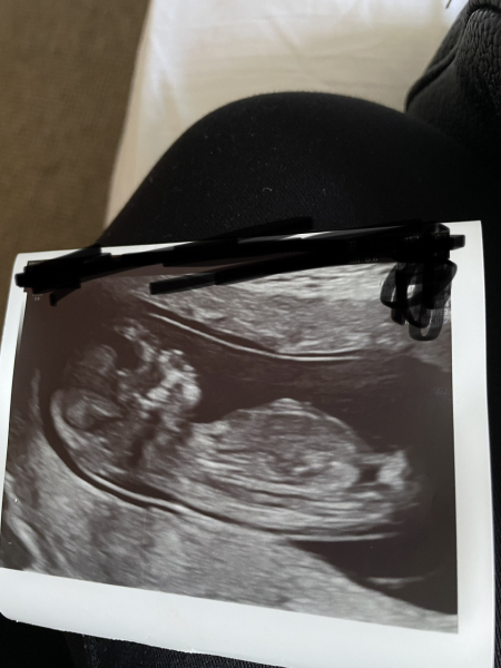 Boy or girl?! :)