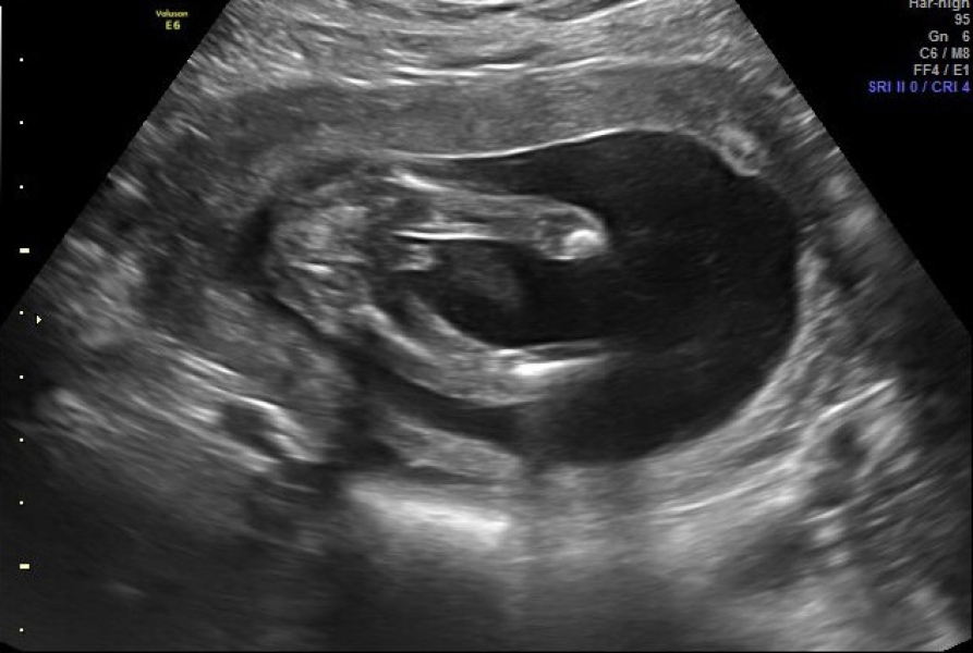 April 2023 - We’re nearly half way! ✨ 🍼