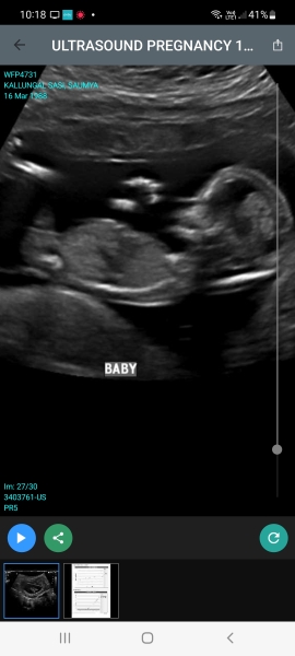 12 week ultra sound gender prediction
