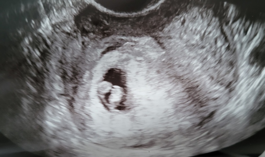 Any gender guesses?