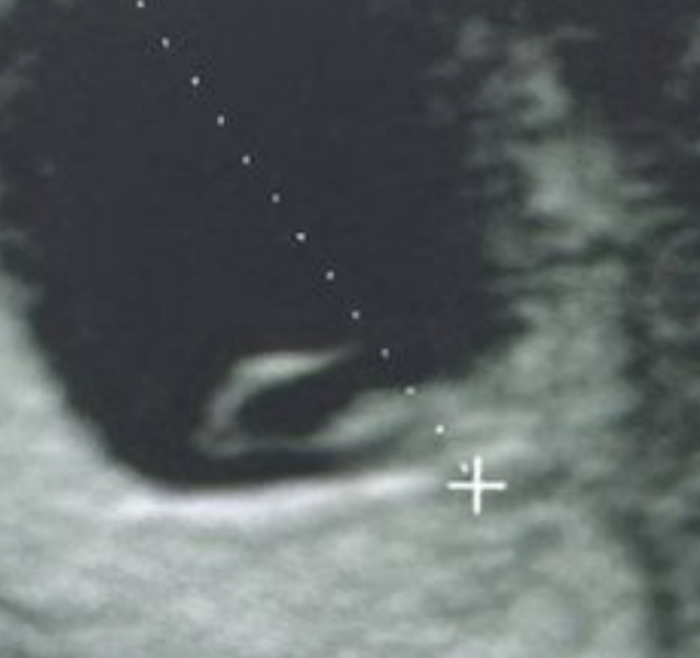 Early scan?