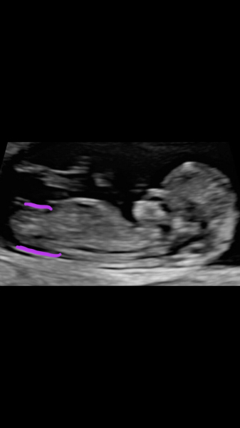 Due April/May after MC 🌈