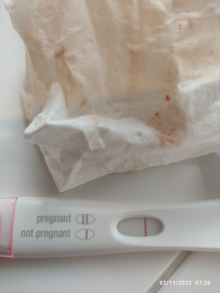 How long does Implantation bleeding last? Anxious!!!