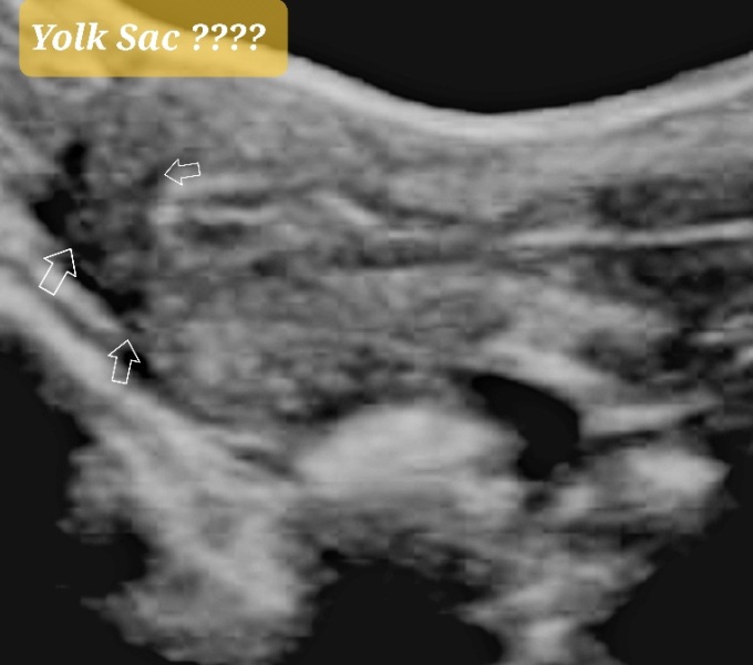 Due May 2023 - thread two