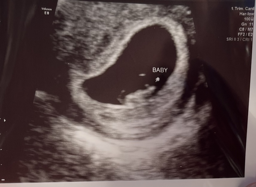 June 2023 Babies ☀️ (thread two)
