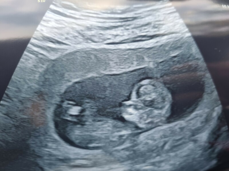 Due May 2023 - thread two