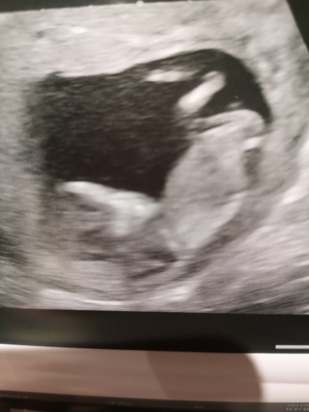 June 2023 Babies ☀️ (Thread 3) 