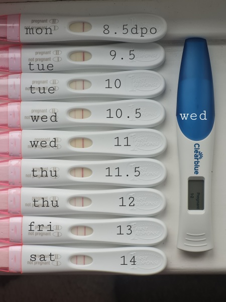 TTC 1 year Varicocele diagnosis